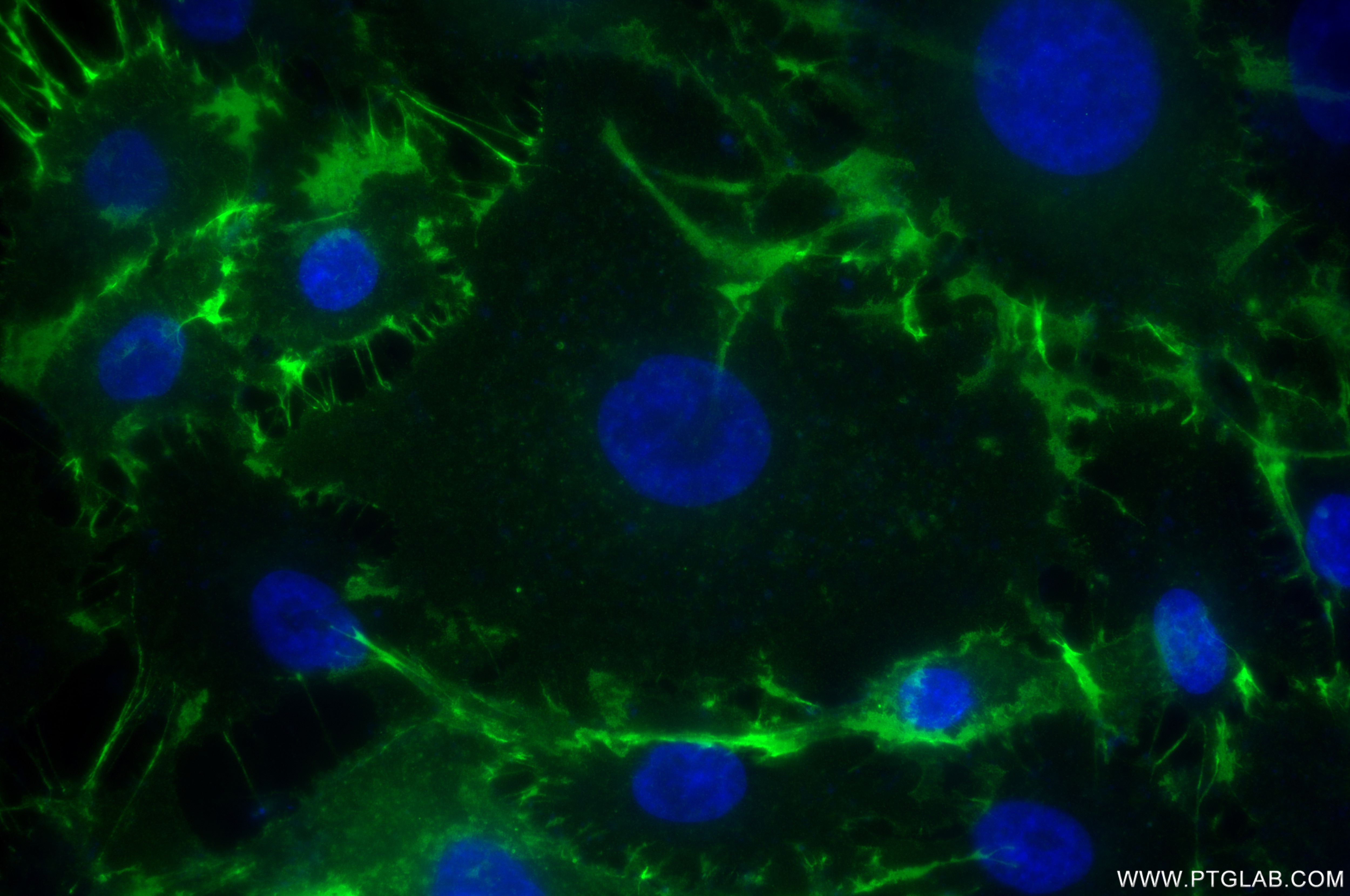 Immunofluorescent analysis of (4% PFA) fixed A549 cells using ALCAM antibody (86811-1-RR, Clone: 251789C7 ) at dilution of 1:400 and CoraLite®488-Conjugated Goat Anti-Rabbit IgG(H+L) (SA00013-2). This data was developed using the same antibody clone with 86811-1-PBS in a different storage buffer formulation. Immunofluorescence (IF) / fluorescent staining of A549 cells using ALCAM Recombinant monoclonal antibody (86811-1-RR)