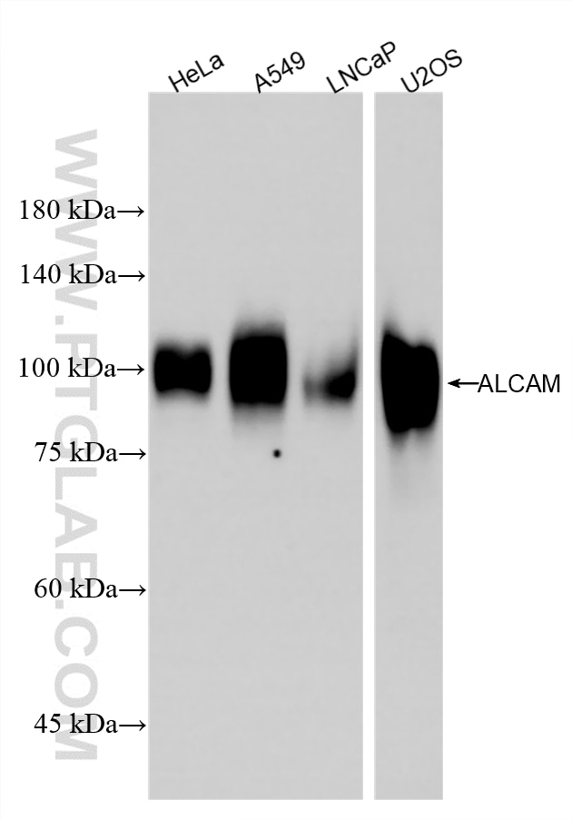 Western Blot (WB) analysis of various lysates using ALCAM Recombinant monoclonal antibody (86811-1-RR)