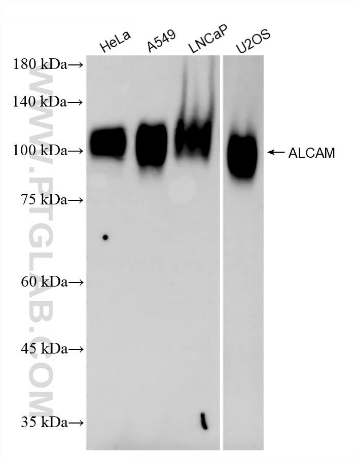 Western Blot (WB) analysis of various lysates using ALCAM Recombinant monoclonal antibody (86811-3-RR)