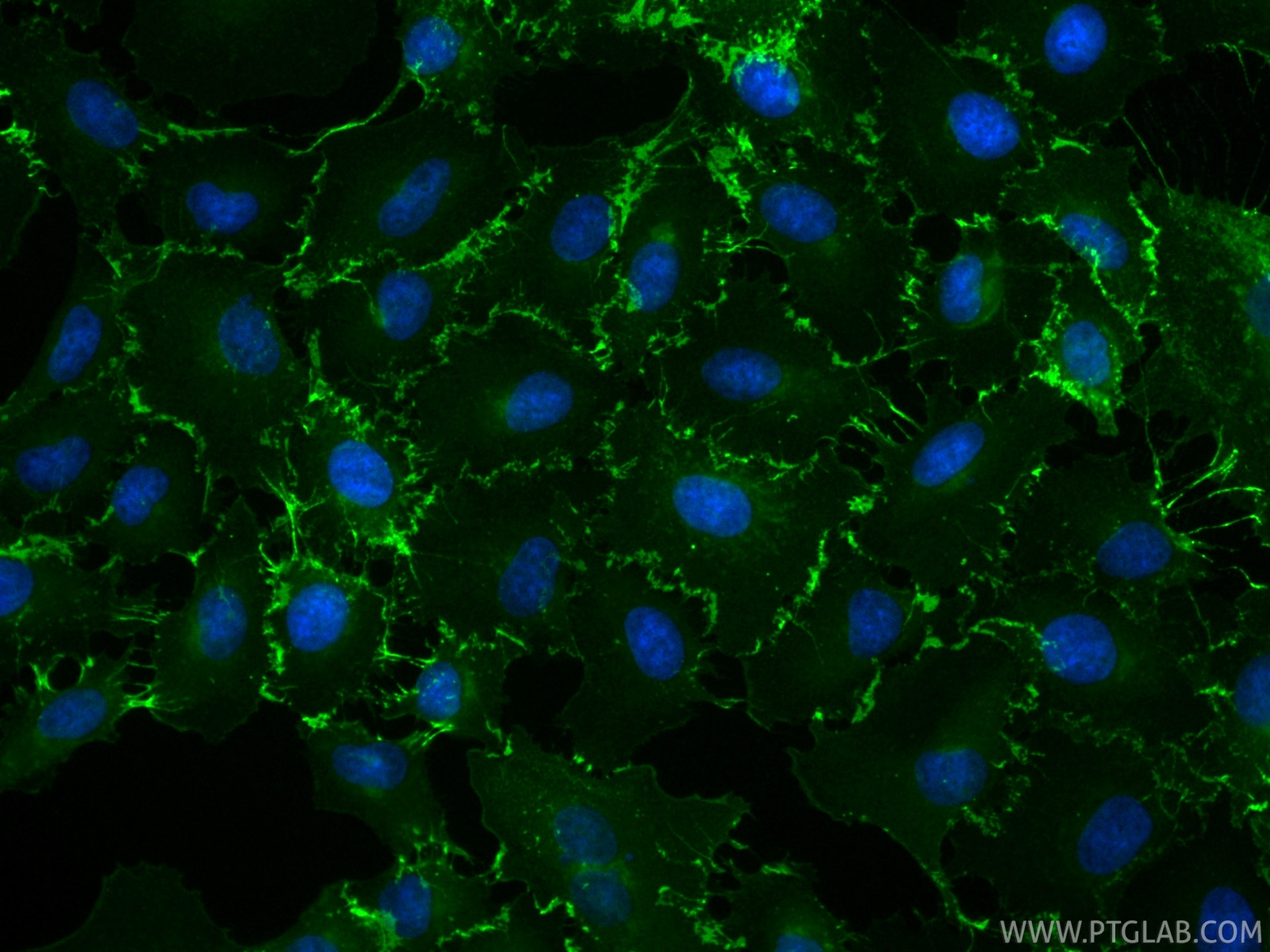 Immunofluorescence (IF) / fluorescent staining of A549 cells using CoraLite® Plus 488-conjugated ALCAM Recombinant mo (CL488-86811-3)