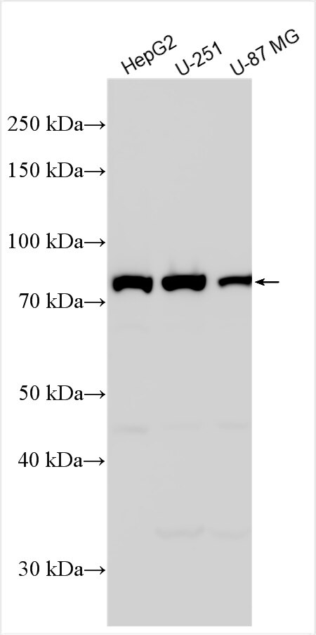 Western Blot (WB) analysis of various lysates using ALDH16A1 Polyclonal antibody (17320-1-AP)