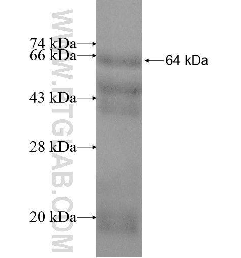 ALDH16A1 fusion protein Ag11296 SDS-PAGE