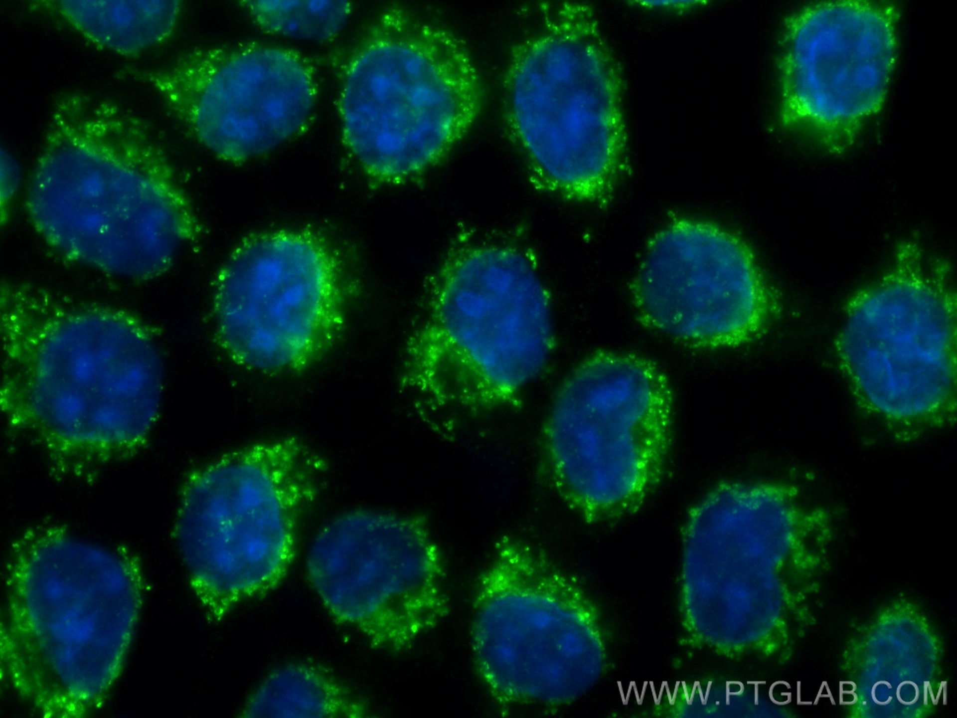 Immunofluorescence (IF) / fluorescent staining of A431 cells using P5CS Polyclonal antibody (17719-1-AP)