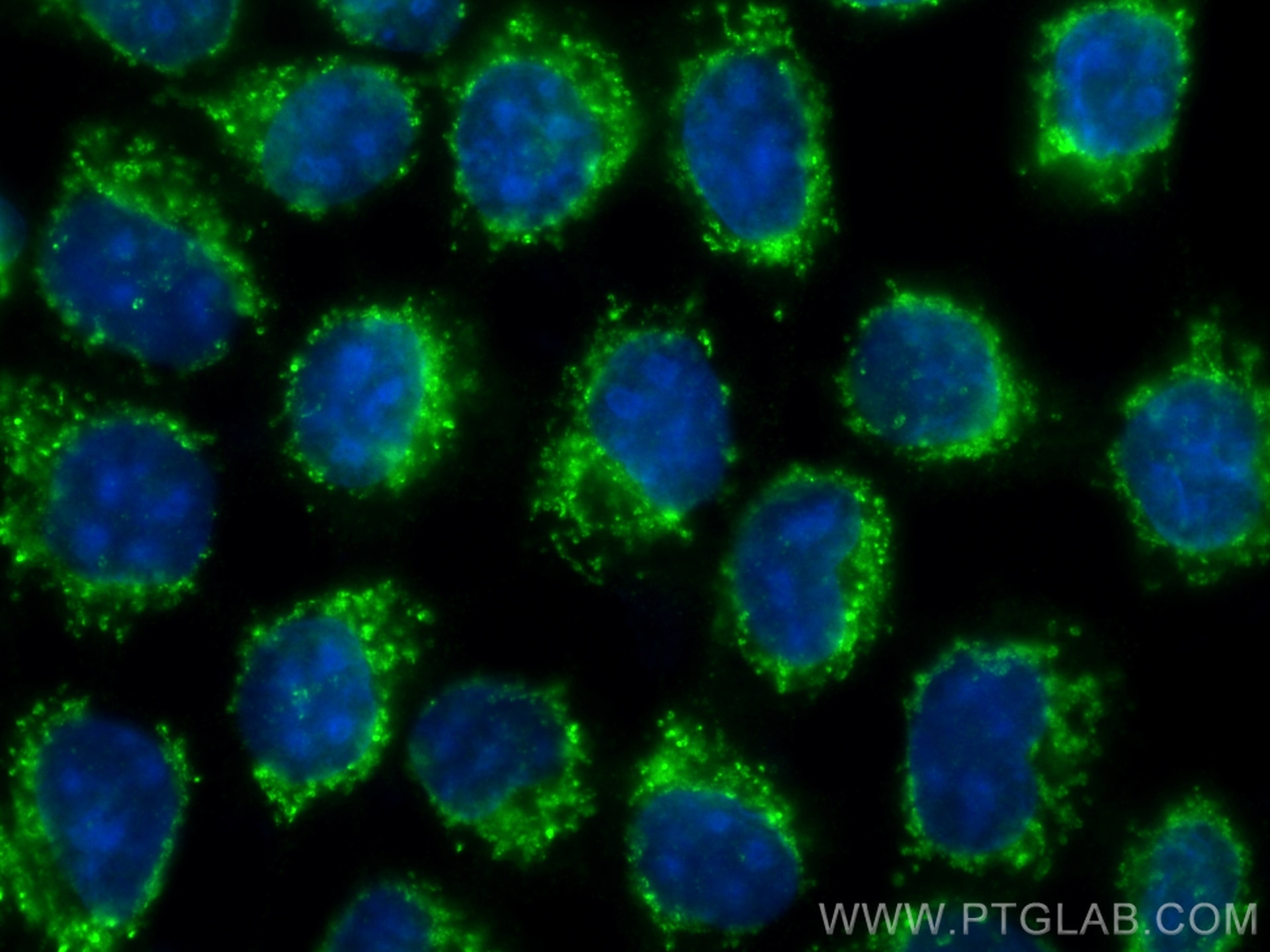 IF Staining of A431 using 17719-1-AP