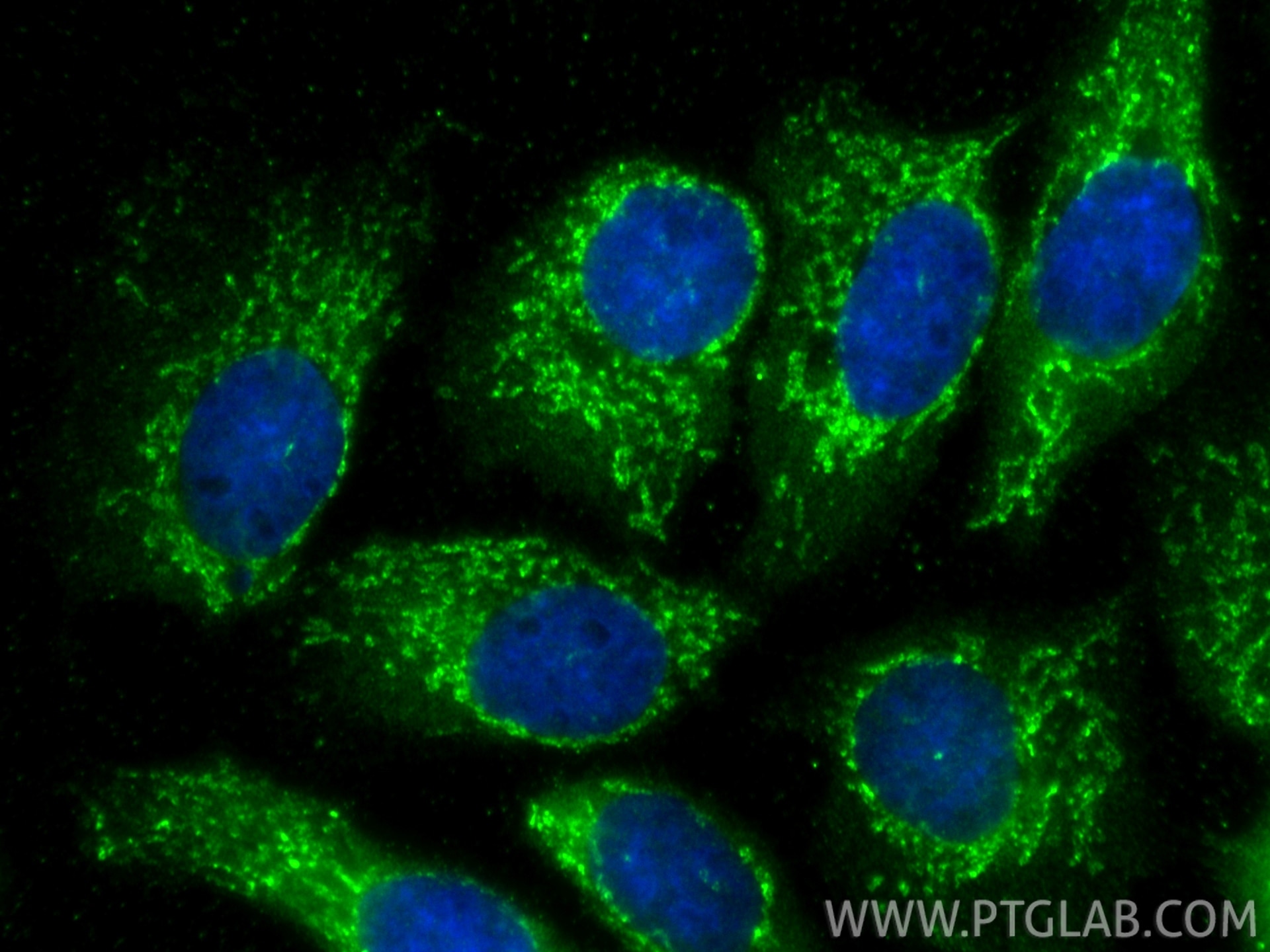 Immunofluorescence (IF) / fluorescent staining of A431 cells using P5CS Polyclonal antibody (17719-1-AP)