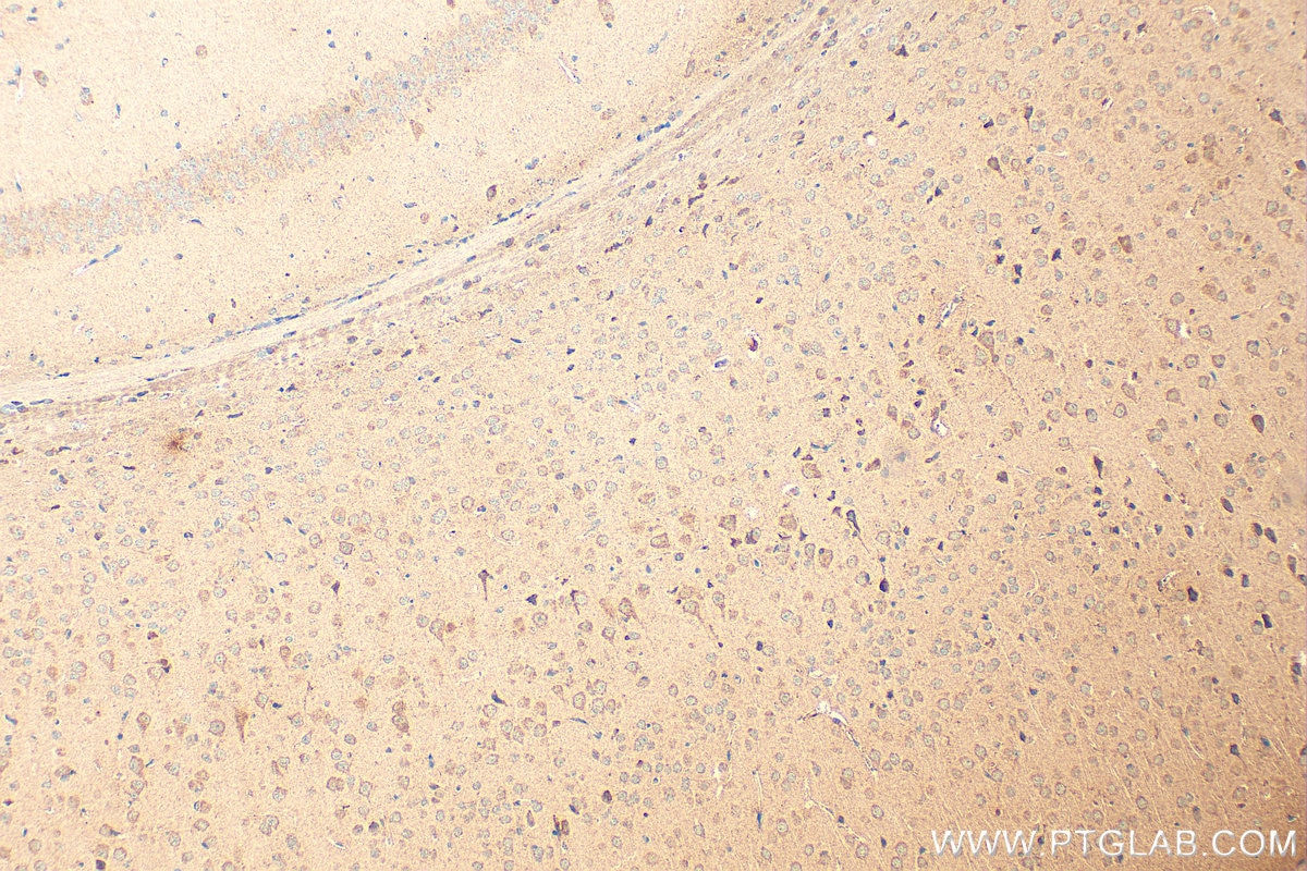 Immunohistochemistry (IHC) staining of mouse brain tissue using P5CS Polyclonal antibody (17719-1-AP)