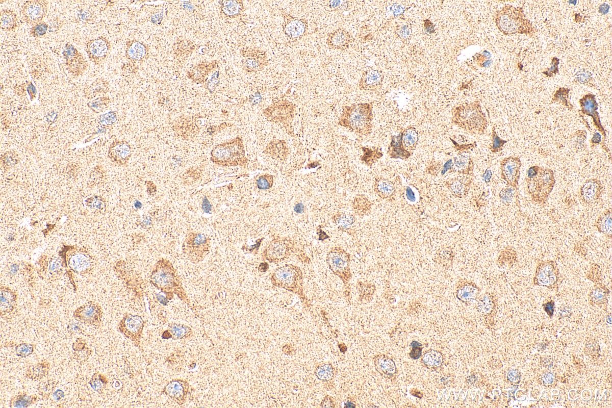 Immunohistochemistry (IHC) staining of mouse brain tissue using P5CS Polyclonal antibody (17719-1-AP)