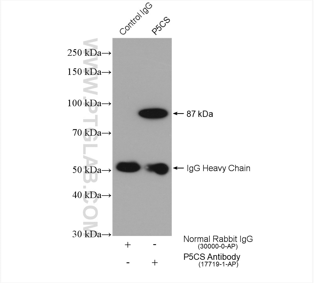 Immunoprecipitation (IP) experiment of mouse brain tissue using P5CS Polyclonal antibody (17719-1-AP)