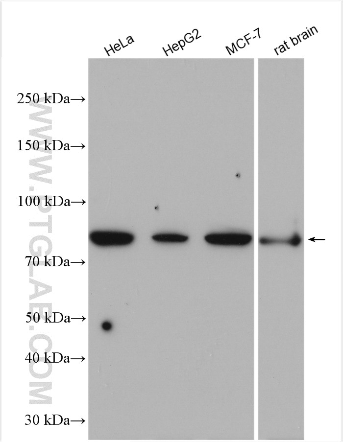 Western Blot (WB) analysis of various lysates using P5CS Polyclonal antibody (17719-1-AP)