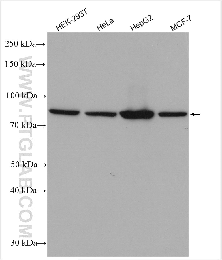 Western Blot (WB) analysis of various lysates using P5CS Polyclonal antibody (17719-1-AP)