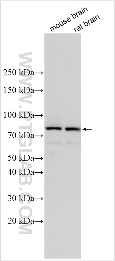 Western Blot (WB) analysis of various lysates using P5CS Polyclonal antibody (17719-1-AP)