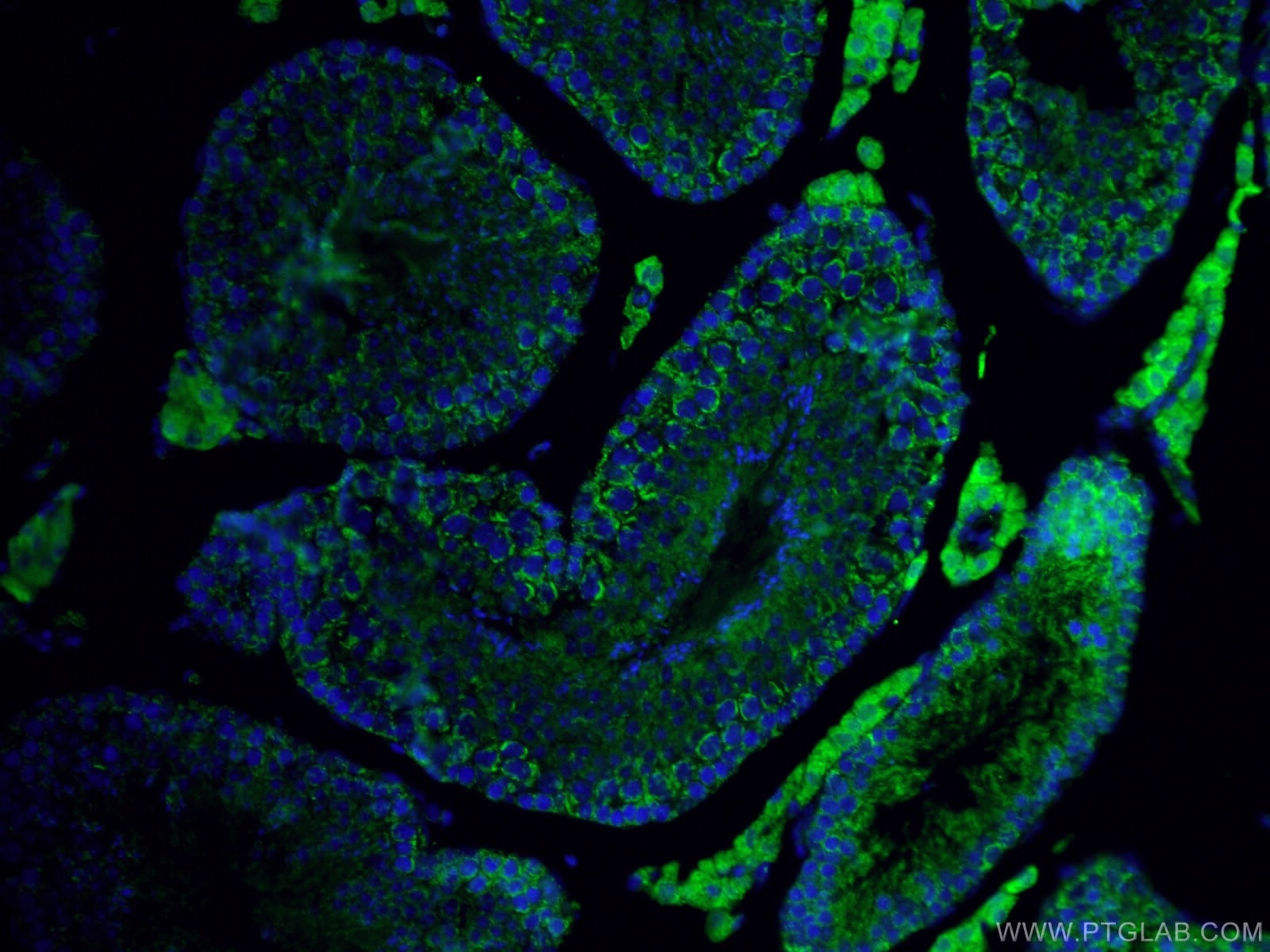 Immunofluorescence (IF) / fluorescent staining of mouse testis tissue using ALDH1A1 Polyclonal antibody (15910-1-AP)