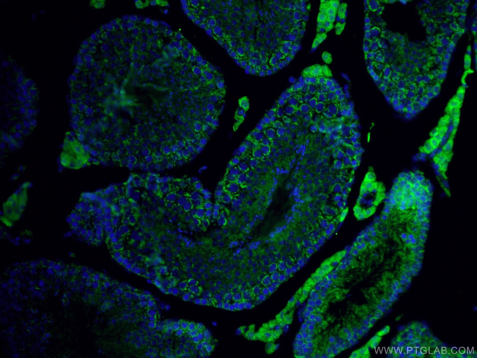 IF Staining of mouse testis using 15910-1-AP