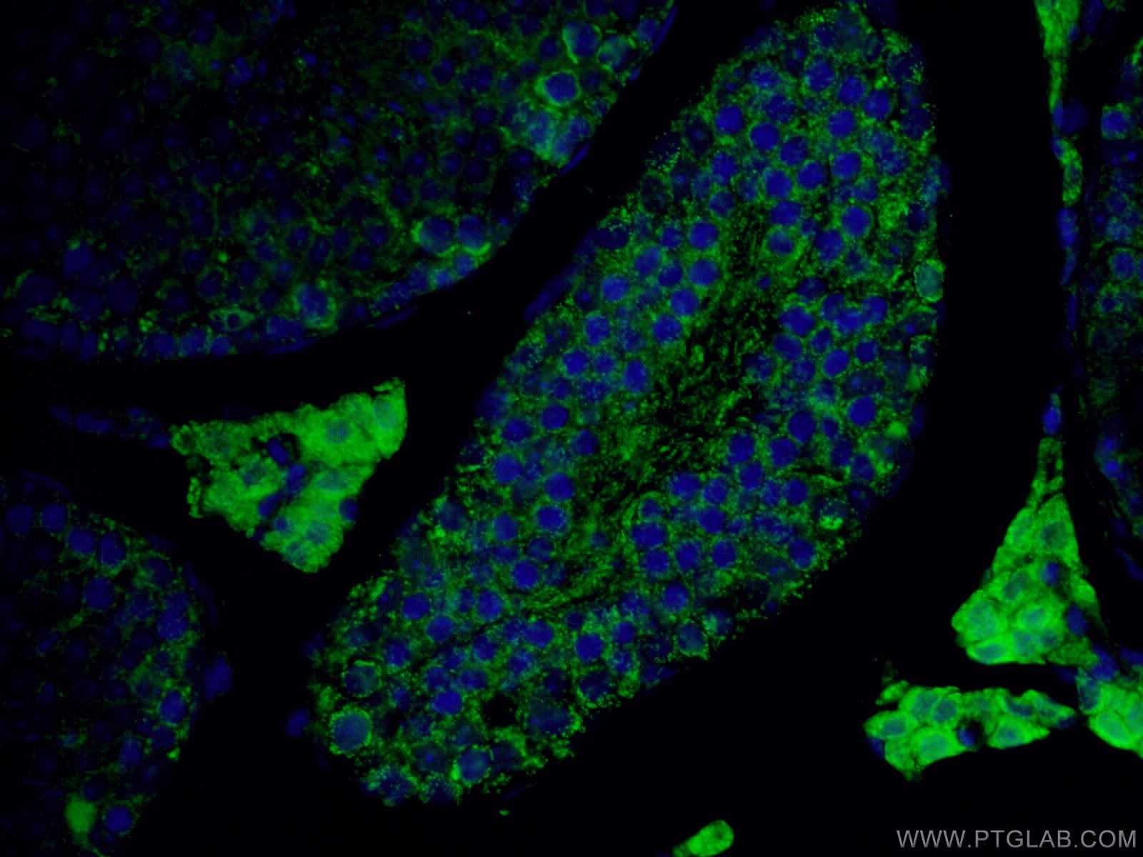 IF Staining of mouse testis using 15910-1-AP