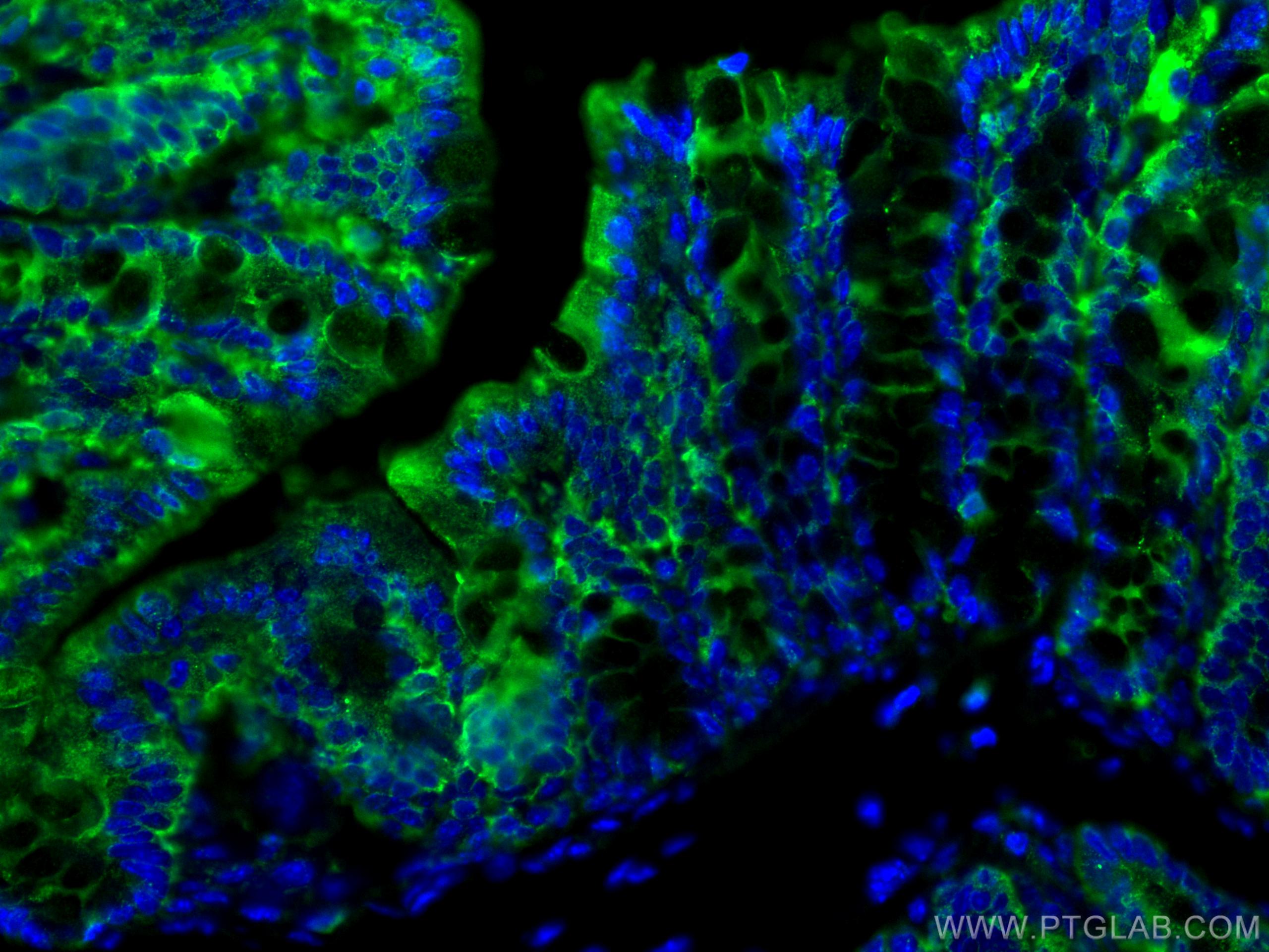 Immunofluorescence (IF) / fluorescent staining of mouse colon tissue using ALDH1A1 Polyclonal antibody (15910-1-AP)