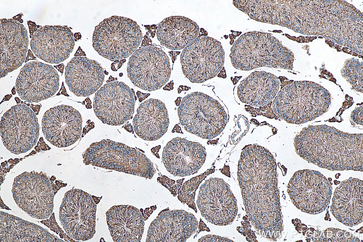 Immunohistochemistry (IHC) staining of mouse testis tissue using ALDH1A1 Polyclonal antibody (15910-1-AP)