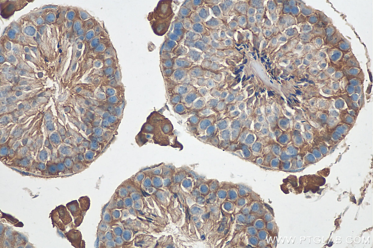 Immunohistochemistry (IHC) staining of mouse testis tissue using ALDH1A1 Polyclonal antibody (15910-1-AP)