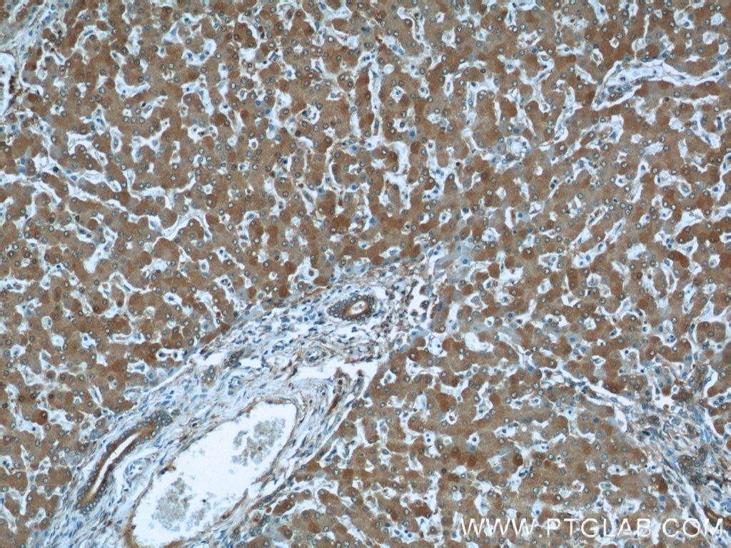 Immunohistochemistry (IHC) staining of human liver tissue using ALDH1A1 Polyclonal antibody (15910-1-AP)