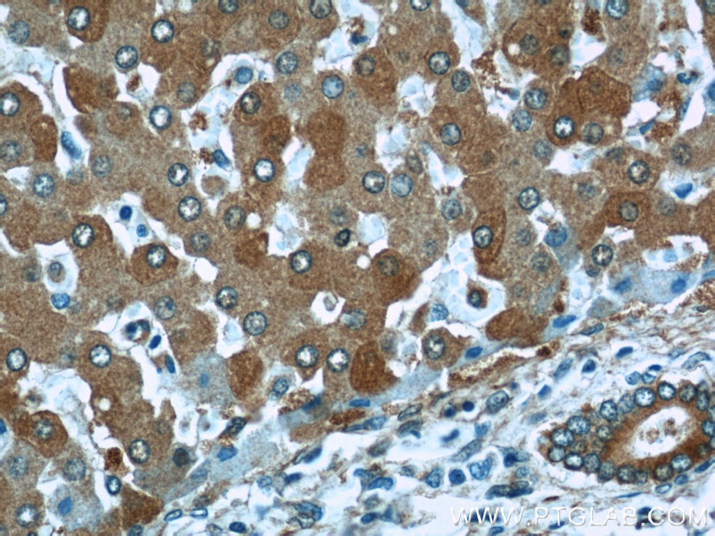 Immunohistochemistry (IHC) staining of human liver tissue using ALDH1A1 Polyclonal antibody (15910-1-AP)