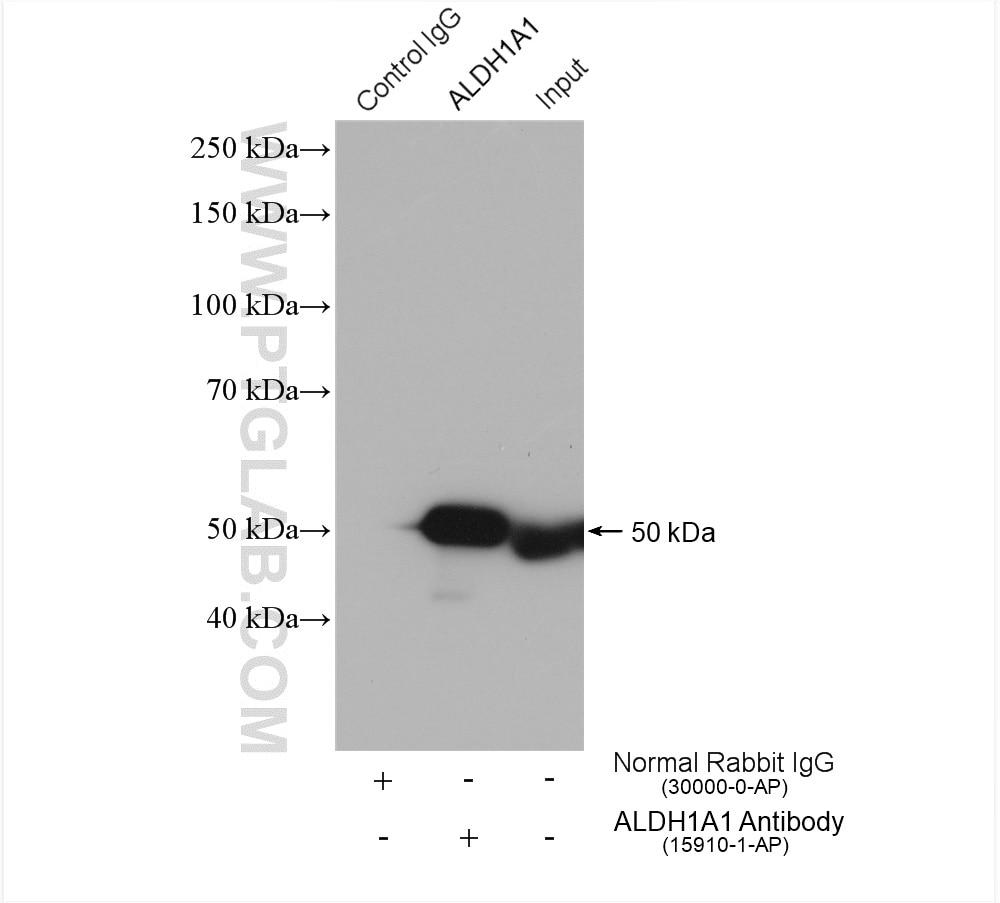 IP experiment of mouse liver using 15910-1-AP