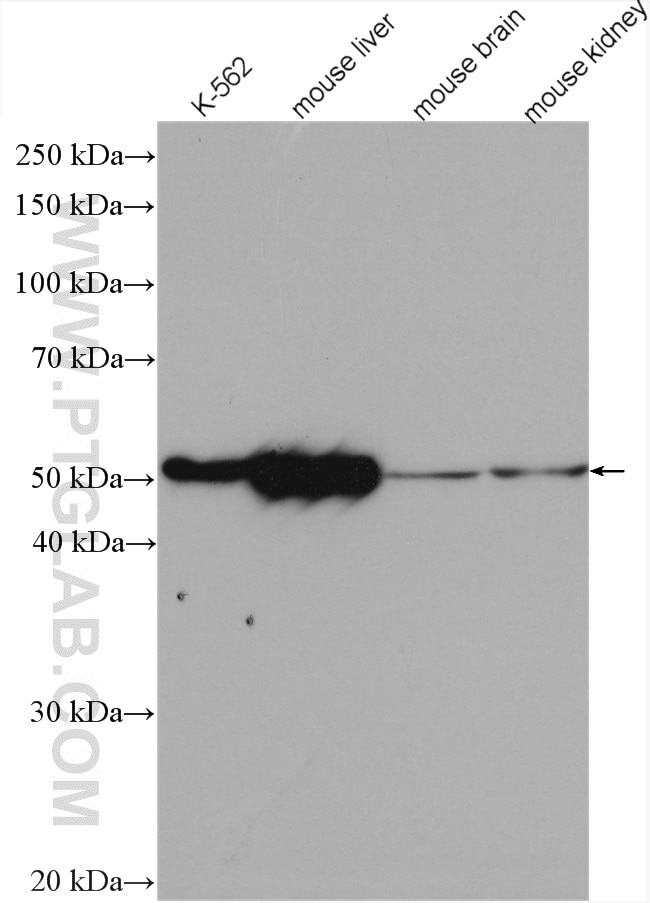 Western Blot (WB) analysis of various lysates using ALDH1A1 Polyclonal antibody (15910-1-AP)