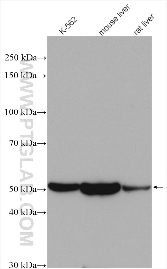 Western Blot (WB) analysis of various lysates using ALDH1A1 Polyclonal antibody (15910-1-AP)