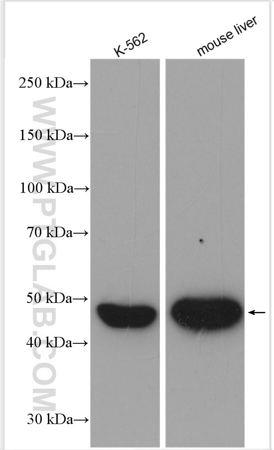 Western Blot (WB) analysis of various lysates using ALDH1A1 Polyclonal antibody (15910-1-AP)