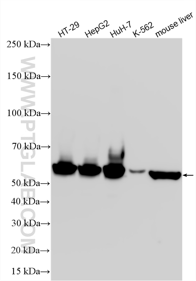 WB analysis using 15910-1-AP Western Blot (WB) analysis of various lysates using ALDH1A1 Polyclonal antibody (15910-1-AP)