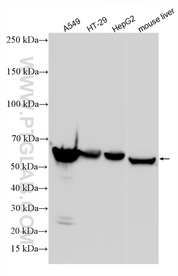 Western Blot (WB) analysis of various lysates using ALDH1A1 Polyclonal antibody (15910-1-AP)