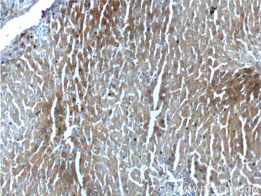 Immunohistochemistry (IHC) staining of human liver tissue using ALDH1A1-specific Polyclonal antibody (22109-1-AP)