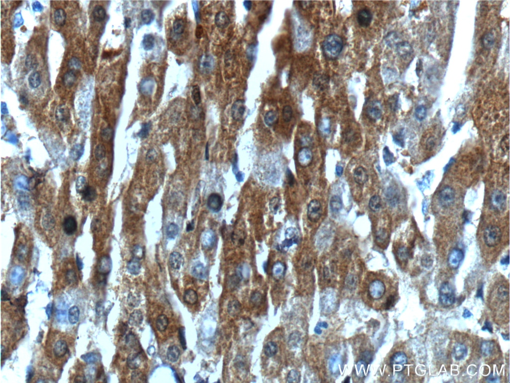 Immunohistochemistry (IHC) staining of human liver tissue using ALDH1A1-specific Polyclonal antibody (22109-1-AP)