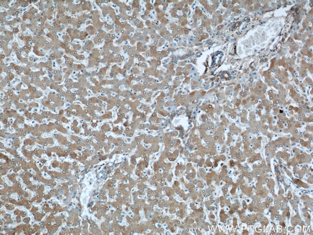 Immunohistochemistry (IHC) staining of human liver tissue using ALDH1A1-specific Polyclonal antibody (22109-1-AP)