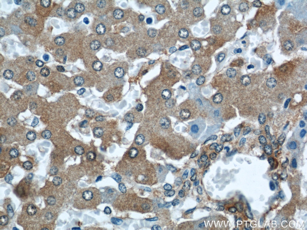 Immunohistochemistry (IHC) staining of human liver tissue using ALDH1A1-specific Polyclonal antibody (22109-1-AP)