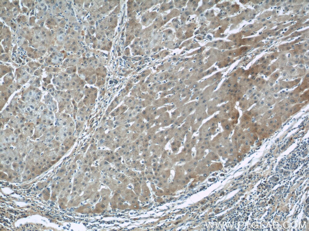 ALDH1A1-specific