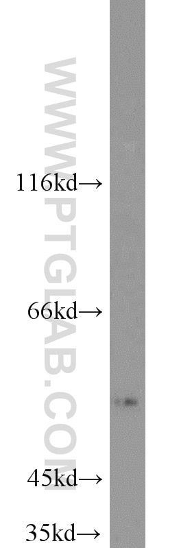 Western Blot (WB) analysis of mouse liver tissue using ALDH1A1-specific Polyclonal antibody (22109-1-AP)