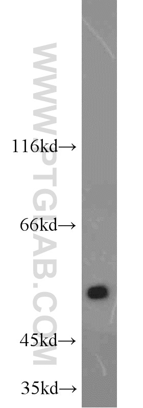 Western Blot (WB) analysis of mouse liver tissue using ALDH1A1-specific Polyclonal antibody (22109-1-AP)