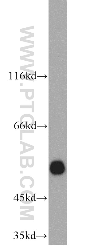 Western Blot (WB) analysis of human liver tissue using ALDH1A1-specific Polyclonal antibody (22109-1-AP)
