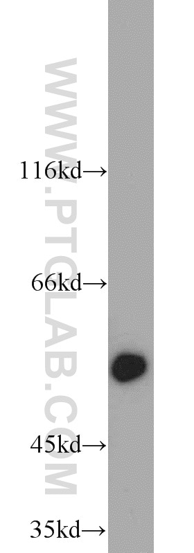 Western Blot (WB) analysis of human adrenal gland tissue using ALDH1A1-specific Polyclonal antibody (22109-1-AP)