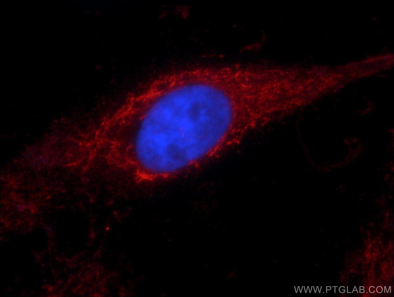 Immunofluorescence (IF) / fluorescent staining of A431 cells using ALDH1A1 Monoclonal antibody (60171-1-Ig)