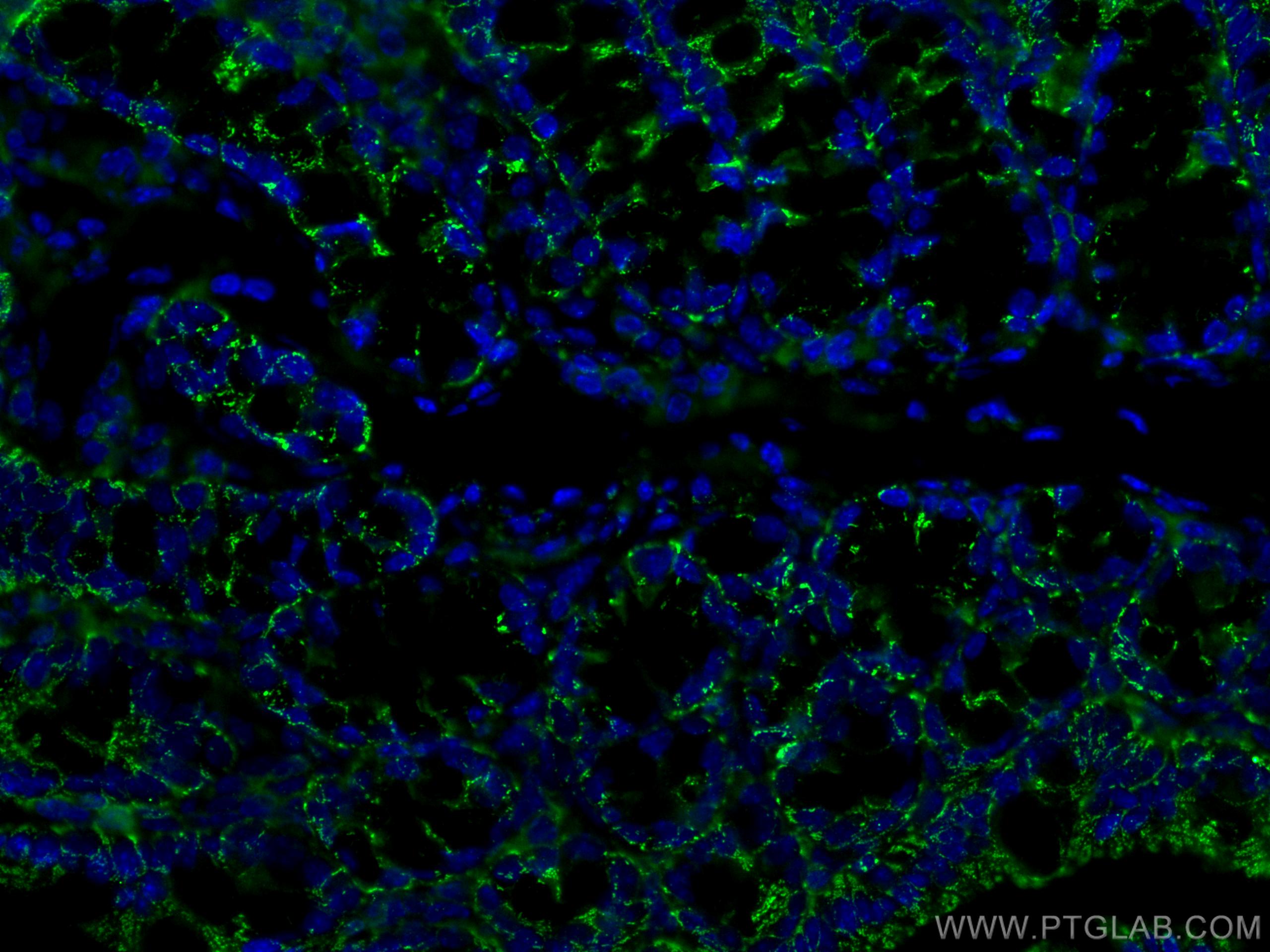 Immunofluorescence (IF) / fluorescent staining of mouse colon tissue using ALDH1A1 Monoclonal antibody (60171-1-Ig)