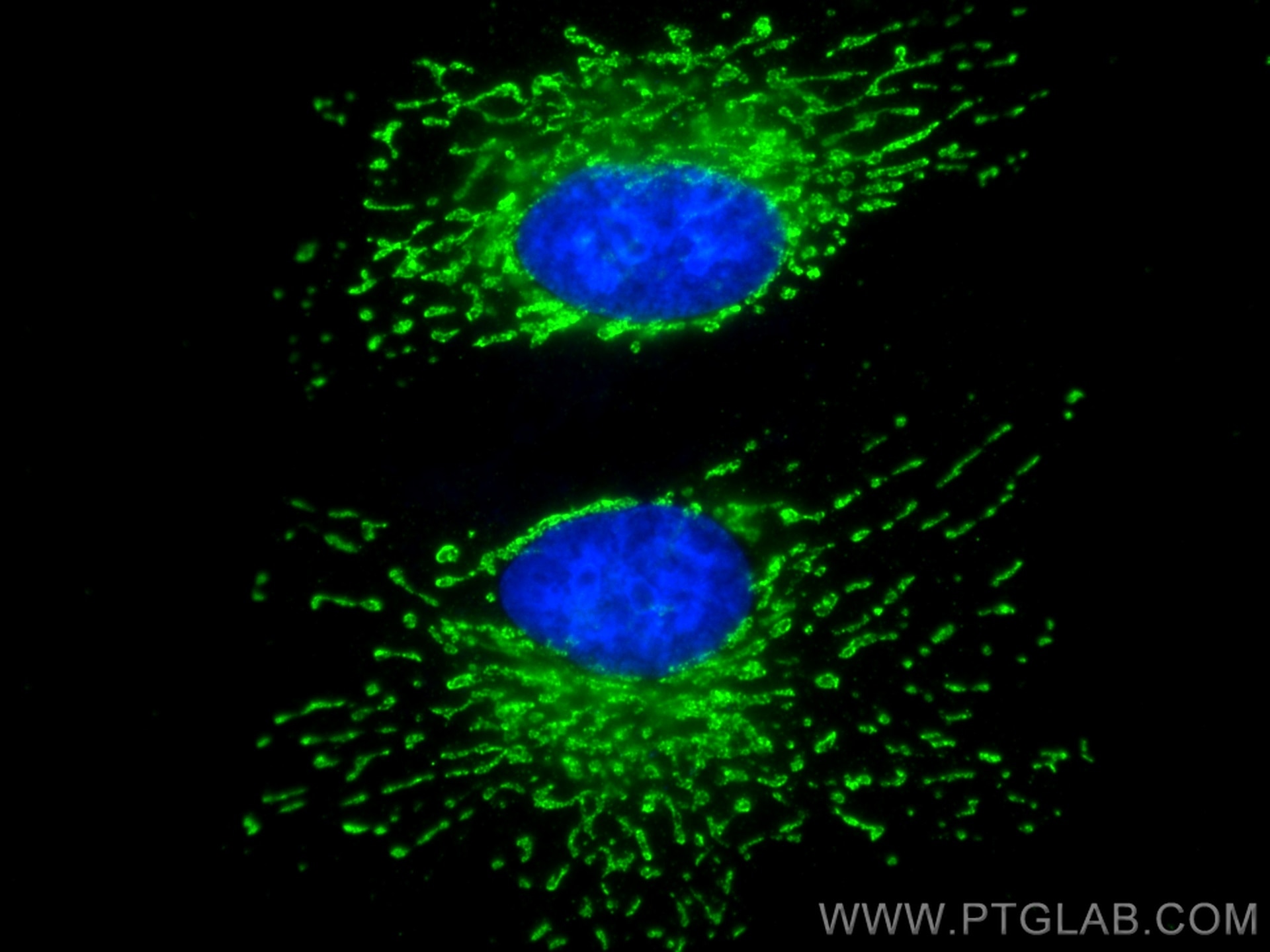 Immunofluorescence (IF) / fluorescent staining of HeLa cells using ALDH1A1 Monoclonal antibody (60171-1-Ig)