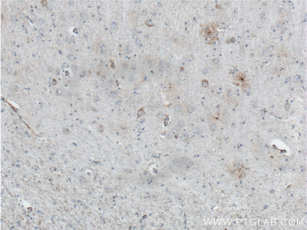 Immunohistochemistry (IHC) staining of human brain tissue using ALDH1A1 Monoclonal antibody (60171-1-Ig)