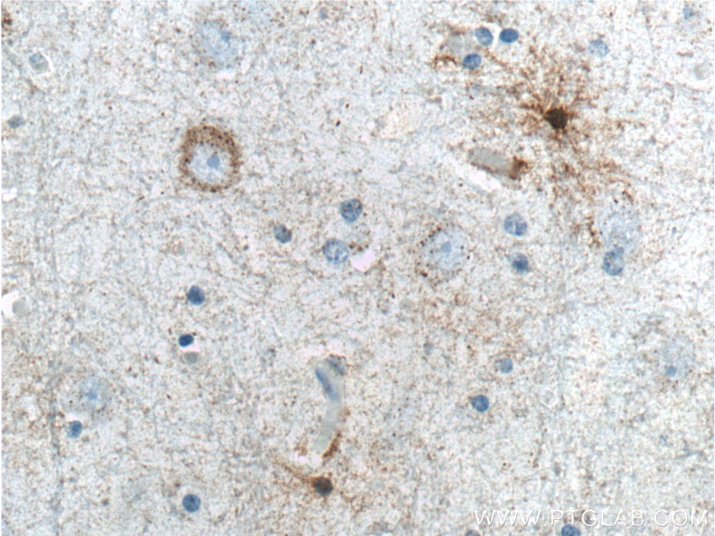 Immunohistochemistry (IHC) staining of human brain tissue using ALDH1A1 Monoclonal antibody (60171-1-Ig)