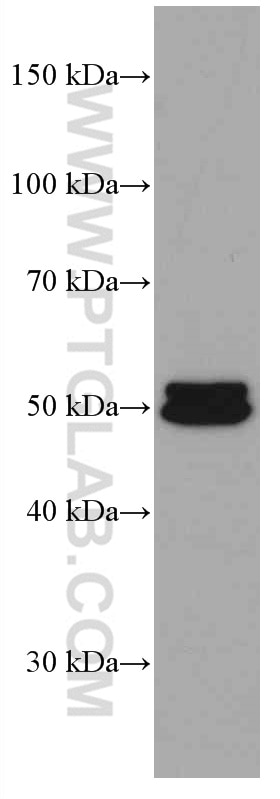 Western Blot (WB) analysis of pig liver tissue using ALDH1A1 Monoclonal antibody (60171-1-Ig)