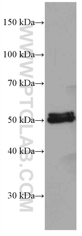 Western Blot (WB) analysis of rat liver tissue using ALDH1A1 Monoclonal antibody (60171-1-Ig)