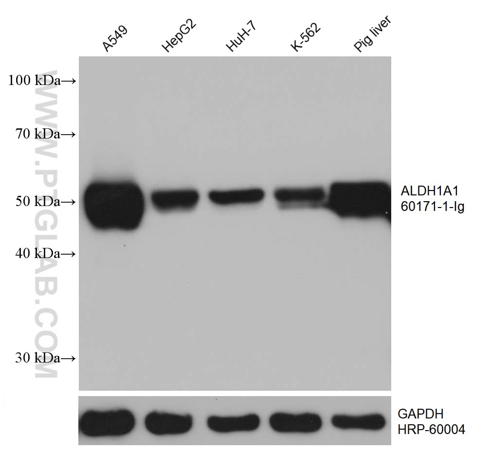 Western Blot (WB) analysis of various lysates using ALDH1A1 Monoclonal antibody (60171-1-Ig)