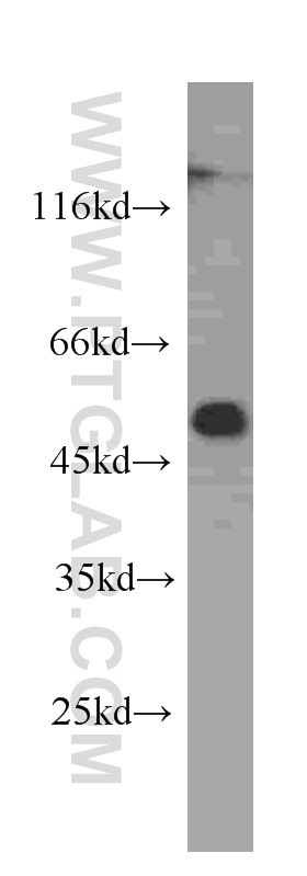 Western Blot (WB) analysis of MCF-7 cells using ALDH1A1 Monoclonal antibody (60171-1-Ig)