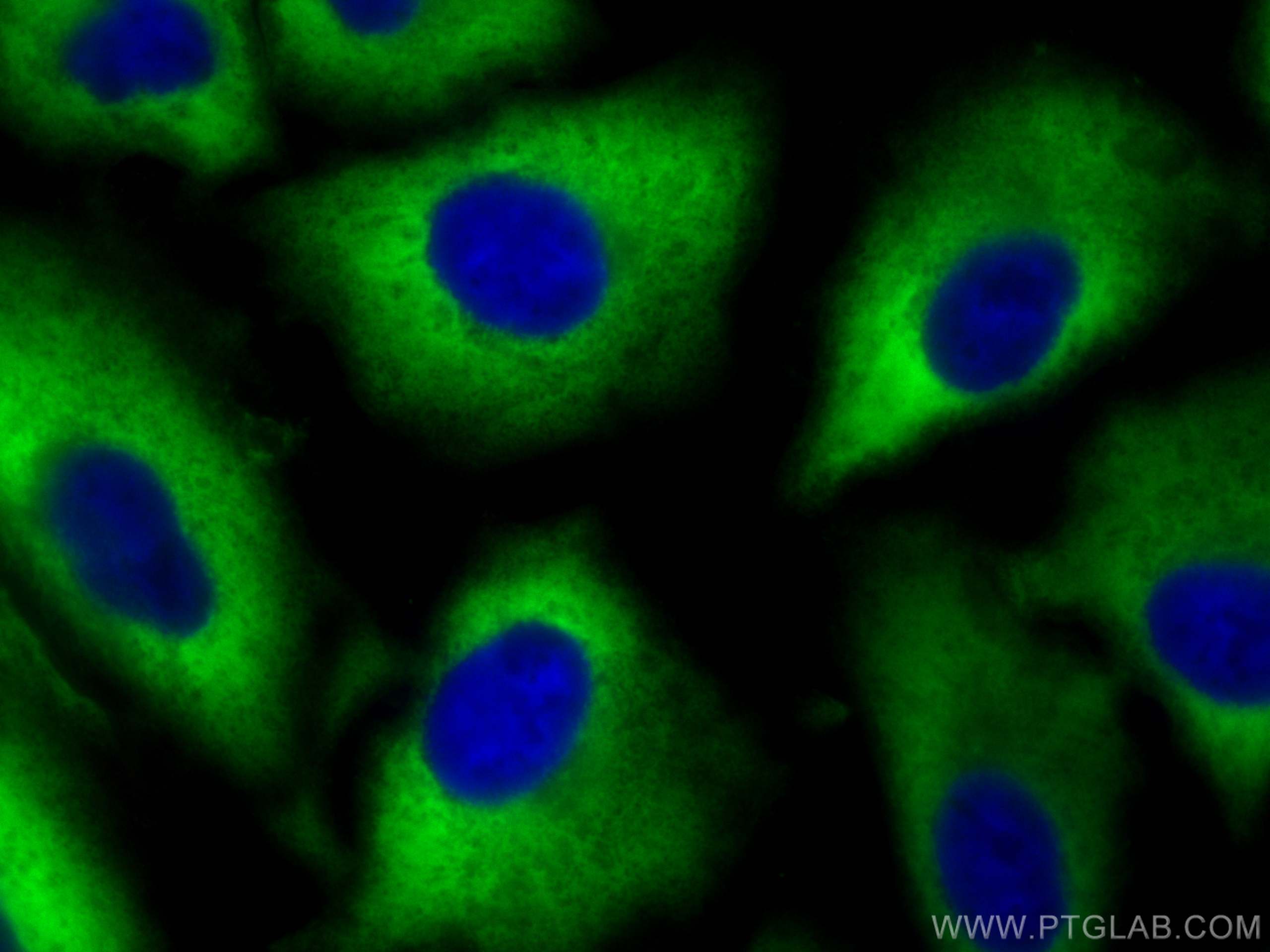 Immunofluorescence (IF) / fluorescent staining of A549 cells using CoraLite® Plus 488-conjugated ALDH1A1 Polyclonal a (CL488-15910)