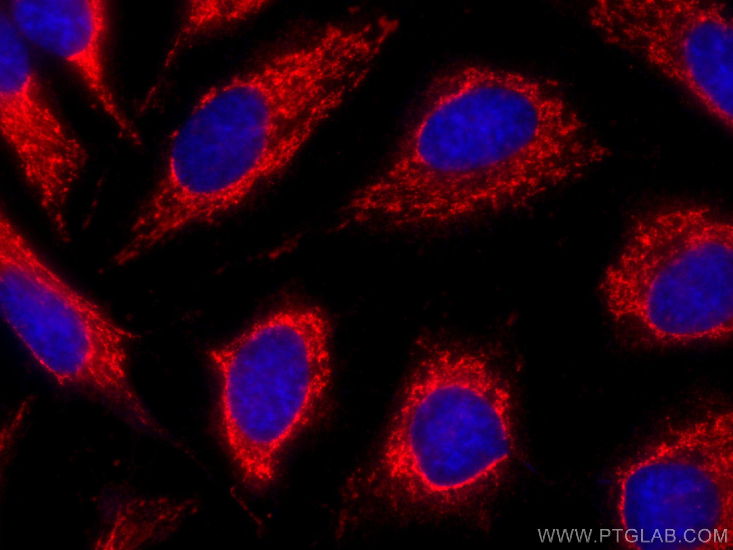 Immunofluorescence (IF) / fluorescent staining of HeLa cells using CoraLite®594-conjugated ALDH1A1 Monoclonal antibod (CL594-60171)