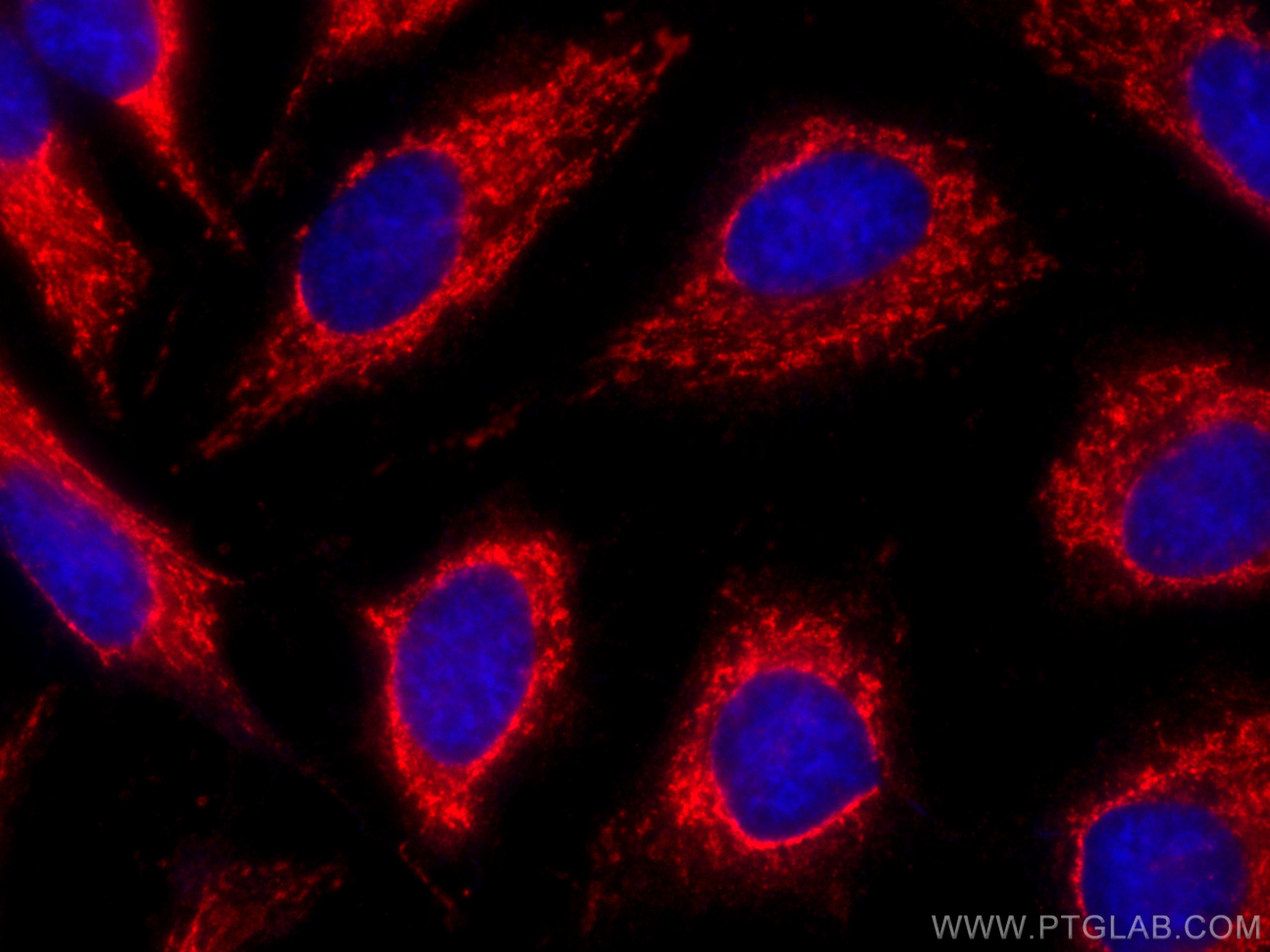 ALDH1A1 antibody (CL594-60171) | Proteintech